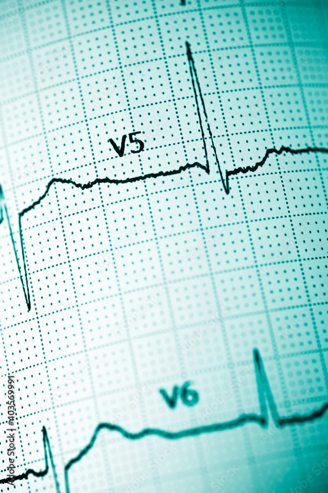 Electrocardiograph closeup view Electrocardiograph closeup view