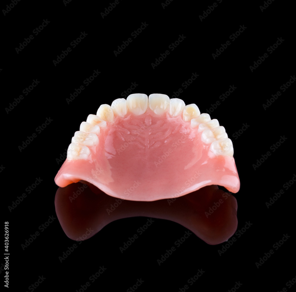 Complete maxillary denture Complete maxillary denture