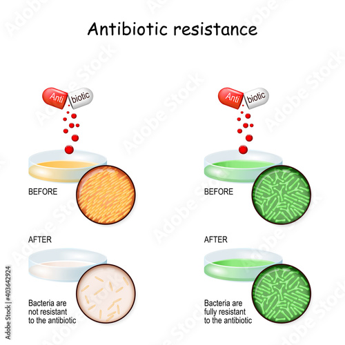 Antibiotic resistance. Experiment