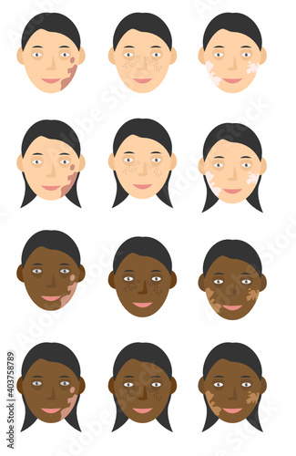 Human face man and woman skin tones, freckles,  pigments and birthmarks vector set graphic illustration clipart isolated