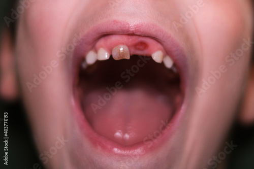 Little baby toothless kid mouth,children health teeth care,dentistry