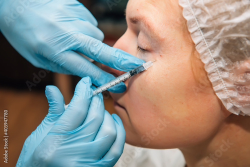 Adult woman with wrinkles around her eyes in process rejuvenation injections of hyaluronic acid filler, close up. Cosmetologist injects botulinum toxin to smooth female face skin.