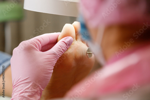 Women's feet and pedicure master. Professional hardware pedicure in a medical salon. Grinding rough skin on the foot with an abrasive disc. Visiting an orthopedic podiatrist.