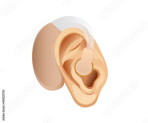 Hearing loss concept. Illustration of the ear with the hearing aid
