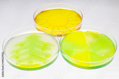 Bacteria growth in petri dish in different forms and colors  photo