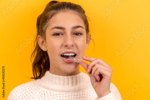 A beautiful girl puts a dental retainer on her teeth  she stands on a yellow background. Orthodontist. Dental tray. Retainer. Advertising. Place for an inscription.