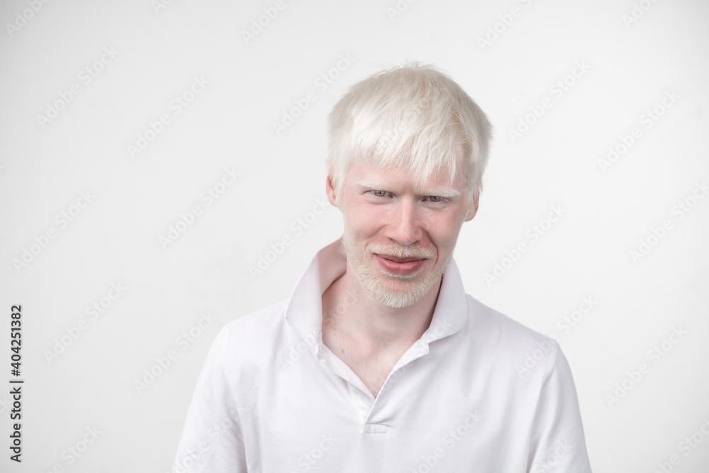 portrait of an albino man in studio dressed t-shirt isolated on a white background. abnormal deviations. unusual appearance portrait of an albino man in studio dressed t-shirt isolated on a white background. abnormal deviations. unusual appearance