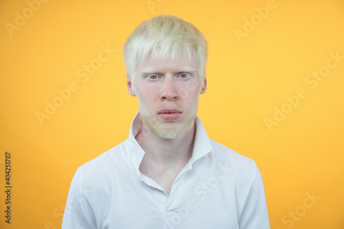Fényképezés albinism albino man in studio dressed t-shirt isolated on a yellow background