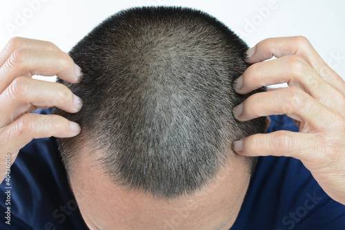 Gray hair problems in men, asian man with gray hair, white hair or hair loss problem.