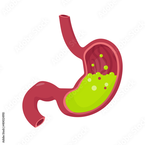 Green liquid inside stomach. Nausea.. Vomiting.