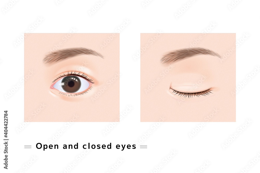 片目 まつげ 女性 顔 目 閉じた まぶた 眼科 症例 リアル イラスト Vector De Stock Adobe Stock