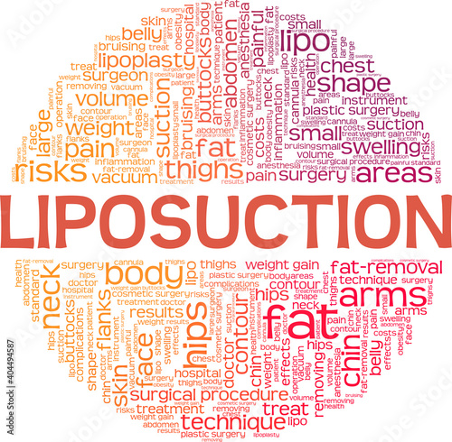 Liposuction vector illustration word cloud isolated on a white background.	