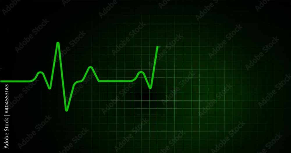 Heart rate graph. Heart beat. Ekg icon wave. Green color on black background. 4k footage.Loop animation. Heart rate graph. Heart beat. Ekg icon wave. Green color on black background. 4k footage.Loop animation.