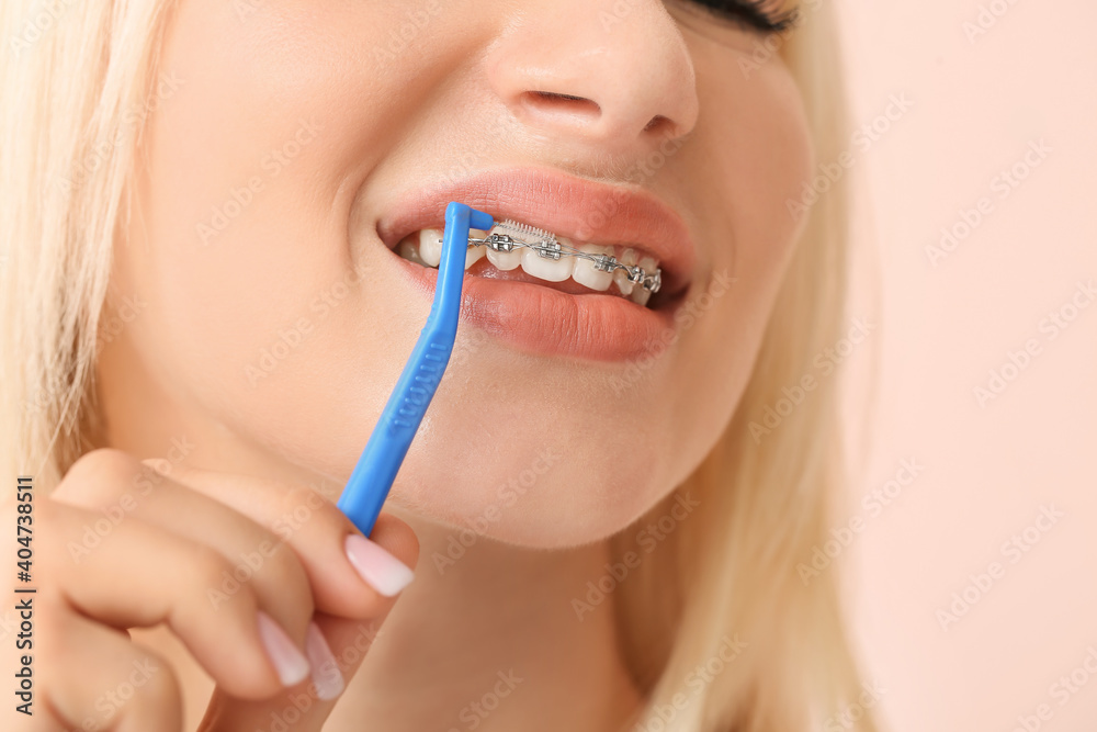 Young woman with dental braces and toothbrush on color background Young woman with dental braces and toothbrush on color background