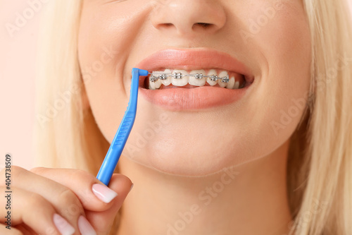 Young woman with dental braces and toothbrush on color background