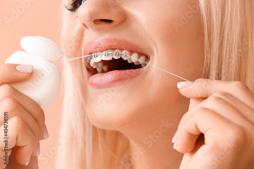 Young woman with dental bra...
