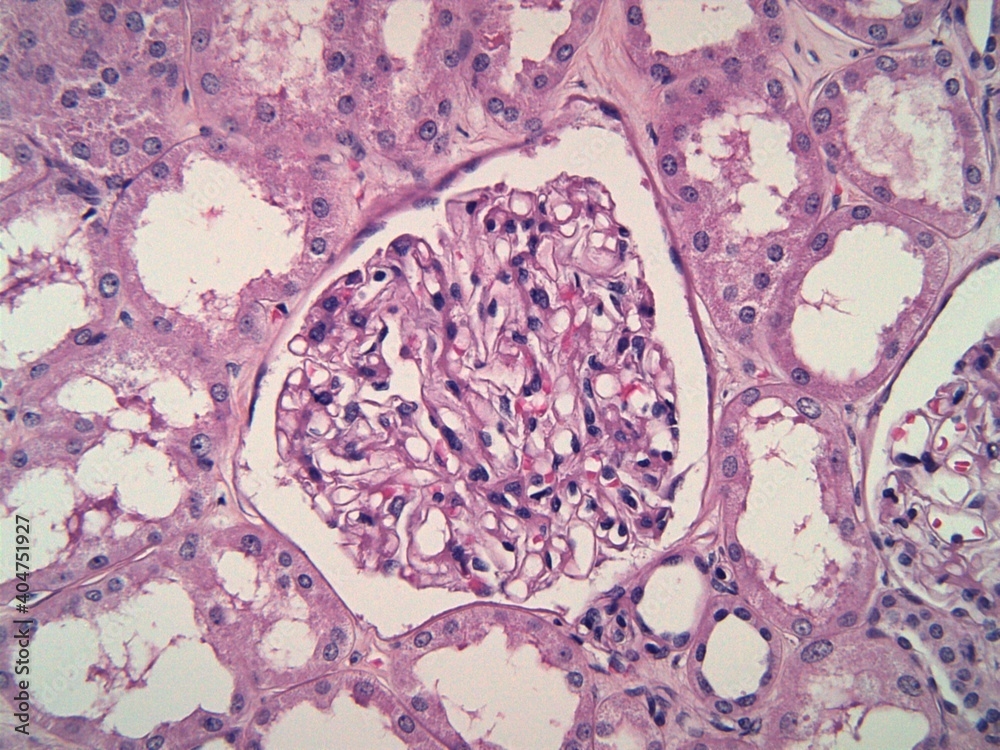 Normal Glomerulus