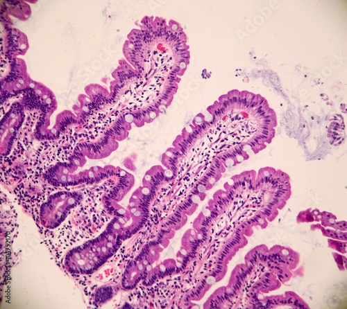 Foto Normal duodenum mucosa showing long, slender villi