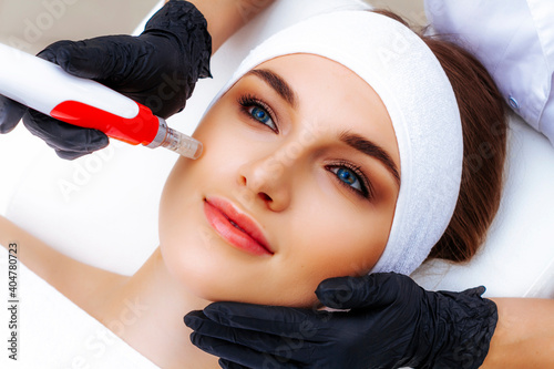 Hardware mesotherapy for the face. Dermapen apparatus photo. Cosmetology procedures.