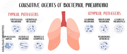 Causative agents of bacterial pneumonia. Acute respiratory tract infections. Typical and atypical pathogens (cocci, bacilli). Morphology. Microbiology. Vector flat illustration