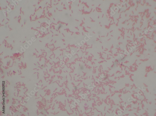 Gram negative bacilli with bipolar stain bacteria.Burkholderia pseudomallei. photo