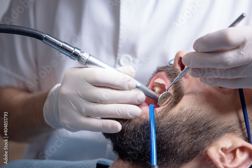Dentist drilling a tooth with a turbine. Saliva ejector is placed in a patient's mouth