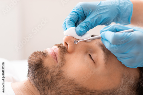 Cosmetologist removing blackheads from middle aged man nose