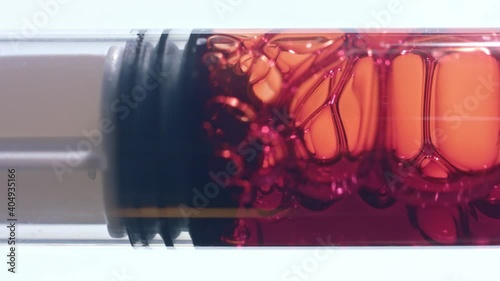 Close up of red liquid drawn into syringe macro shot of bubbly blood
