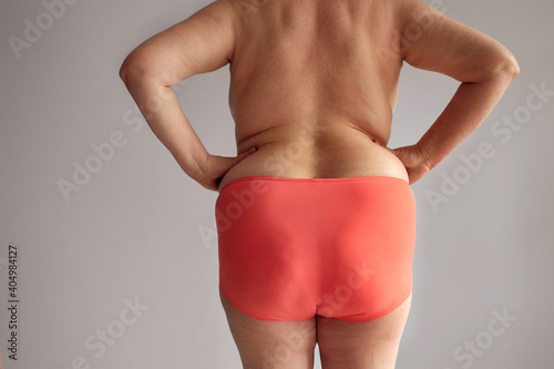 Obese woman with thick buttocks, obese female body