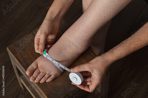 Woman measuring foot affected by lymphedema condition with tape measure photo