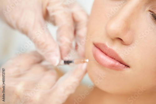 Lip injection at spa salon. Doctor hands. Closeup view. Pretty female patient. Beauty treatment. Healthy skin procedure. Young woman lifting. Facial treatment. Dermatology detox therapy. Rejuvenation