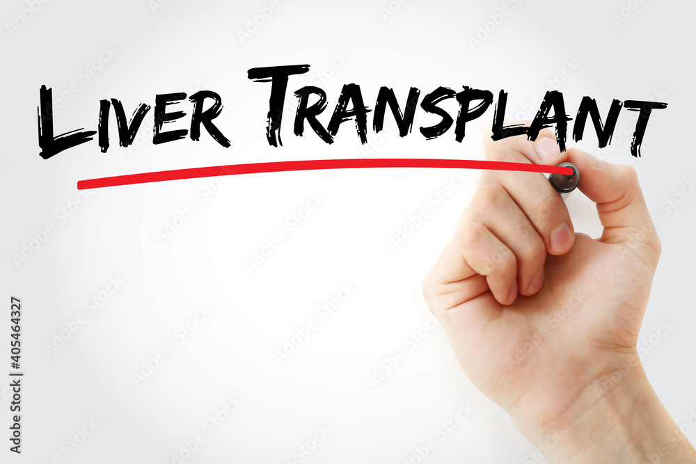 Liver transplant text with marker, concept background Liver transplant text with marker, concept background