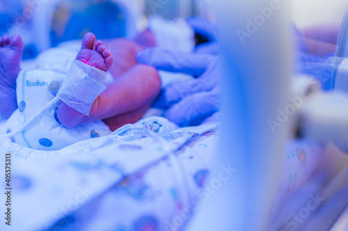Three-day-old newborn baby in intensive care unit in a medical incubator. Feet of new born baby under ultraviolet lamp in the incubator. Newborn rescue concept. The work of resuscitation doctors.