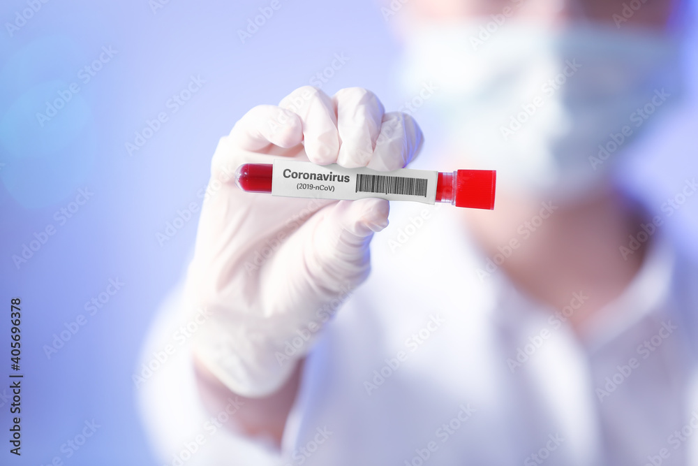 Scientist with sample of covid-19 in laboratory Scientist with sample of covid-19 in laboratory