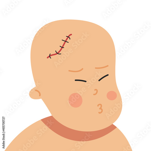 A child with a scar on his head after surgery. Pain from scarring. Medical treatment of children.
