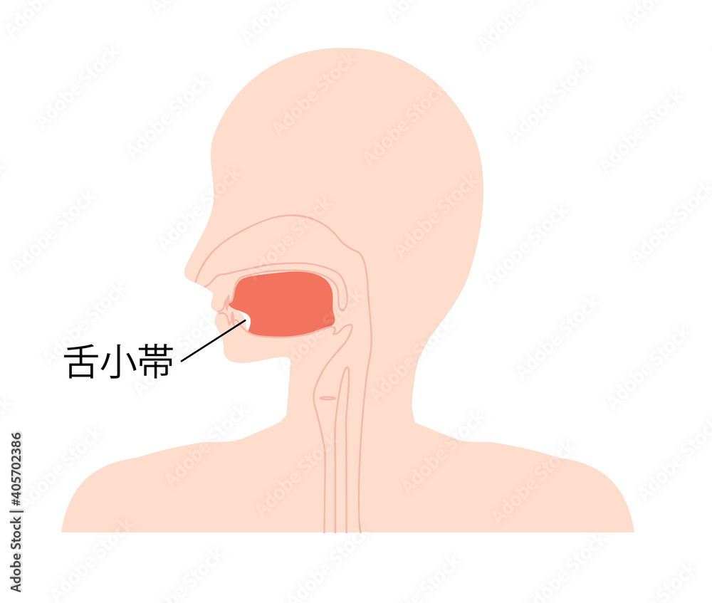 舌小帯のイラスト 舌小帯のイラスト