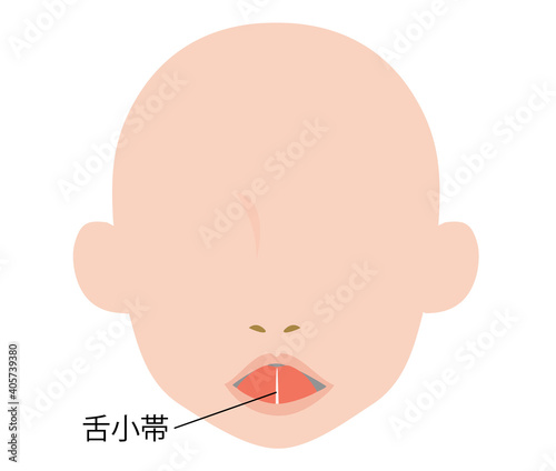 舌小帯のイラスト