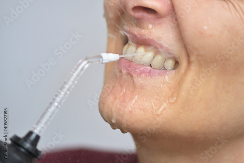 Portrait Of A Young Womanand and Professional Oral Irrigator photo