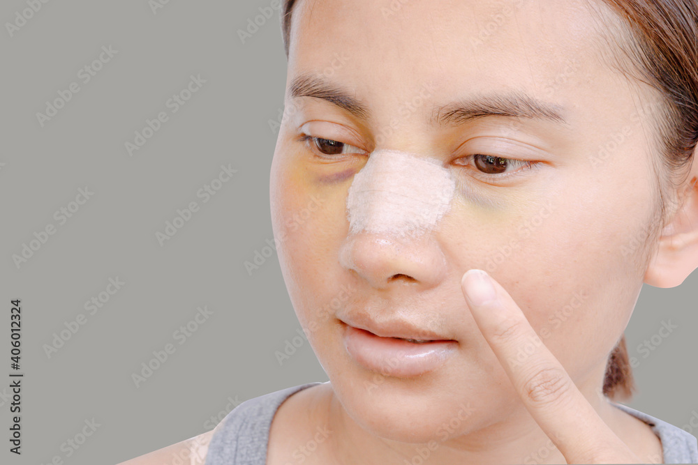 portrait of beautiful young female face with bandage on her nose - beauty treatment plastic surgery isolated on gray background