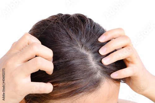 Yong woman hand itchy scalp dandruff problem, Hair care concept