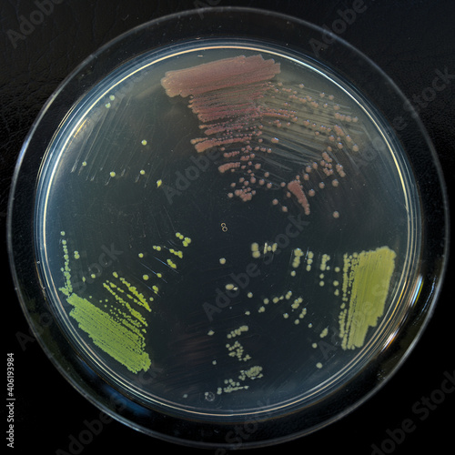 Petri dish of bacteria expressing fluorescent proteins under white light; E. coli expressing GFP, RFP, and YFP