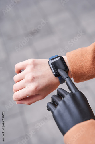 Woman with implant arm checking time from smart watch