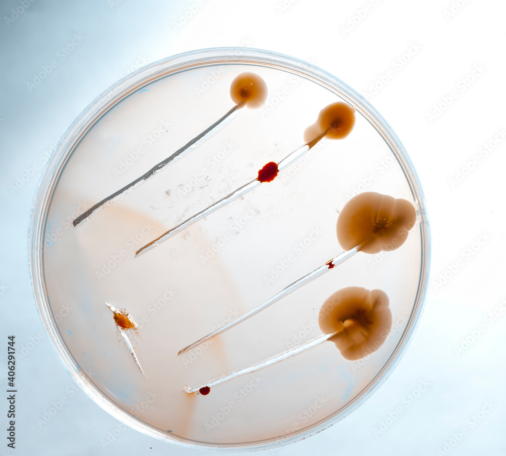 image of bacteria in laboratory placed in a receptacle image of bacteria in laboratory placed in a receptacle