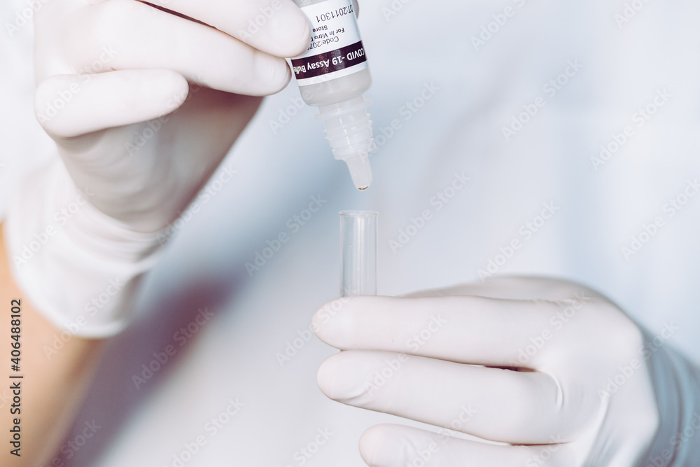 A nurse wearing latex gloves puts drops from the serological bottle into the tube and then rubs the swab to detect a covid-19 patient. A nurse wearing latex gloves puts drops from the serological bottle into the tube and then rubs the swab to detect a covid-19 patient.