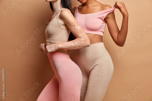 Unrecognizable women have perfect figure different skin condition pose in cropped top and leggings against brown background. Vitiligo affected female. photo