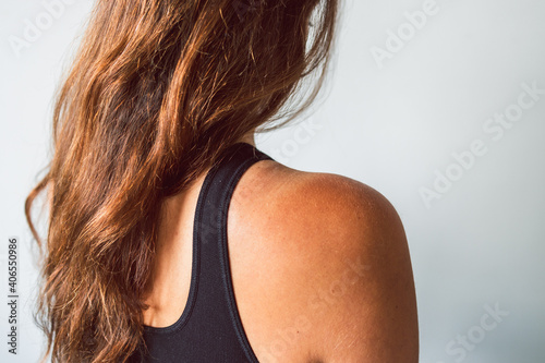sun exposure and sunscreen use, girl revealing intense tan lines on her shoulder