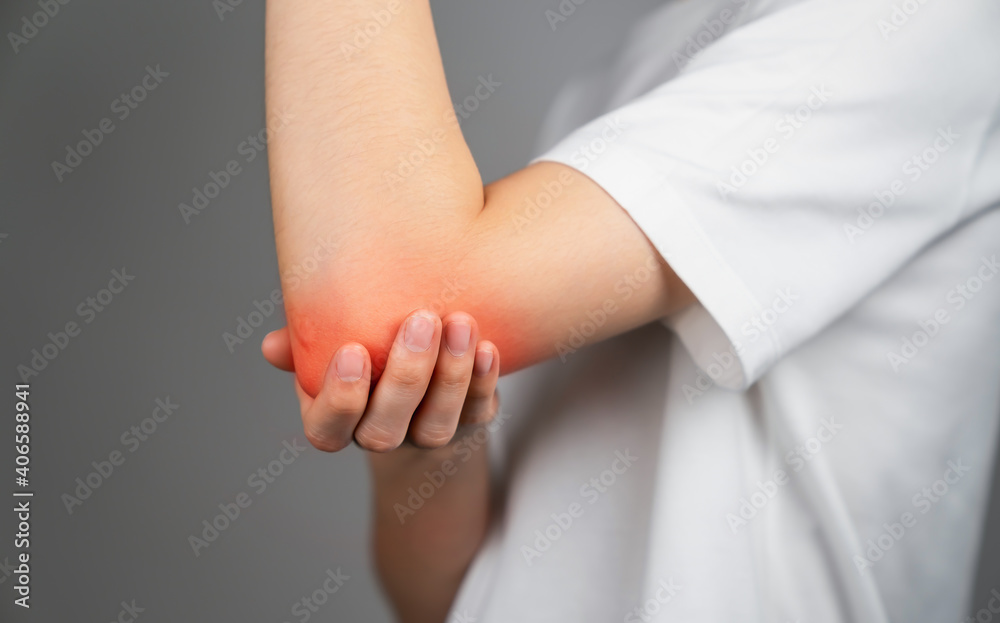 Young woman has a red mark on her elbow, Caused by itching due to insect stings or chemical allergies Young woman has a red mark on her elbow, Caused by itching due to insect stings or chemical allergies