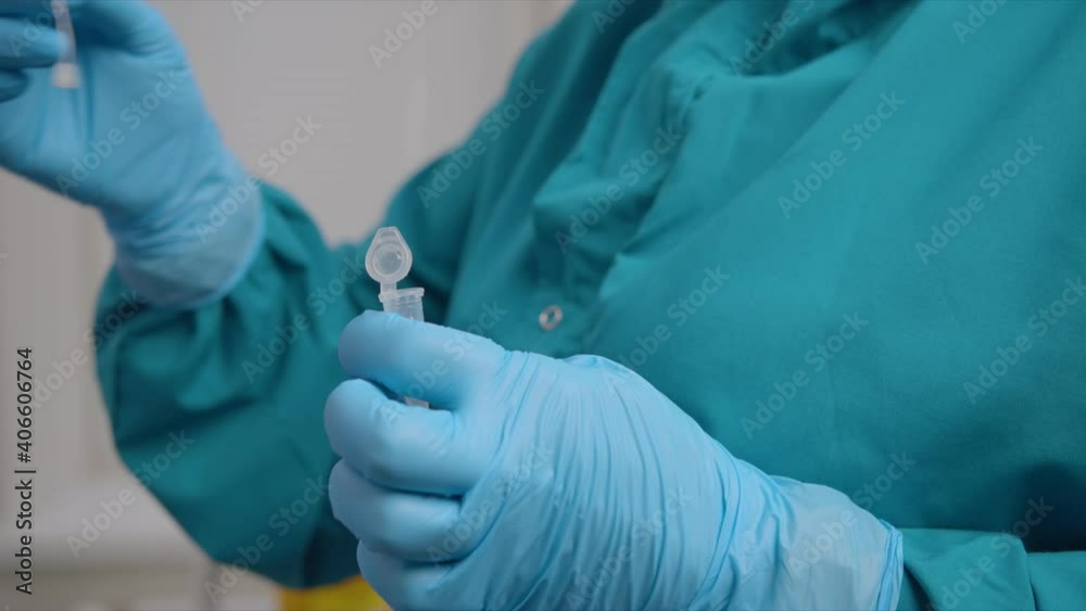 Doctor puts coronavirus smear sample into container closeup Doctor puts coronavirus smear sample into container closeup