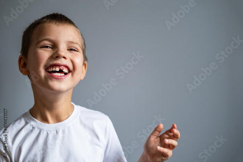 Tableau sur toile Boy without milk upper tooth in white t-shirt smiling on the gray background