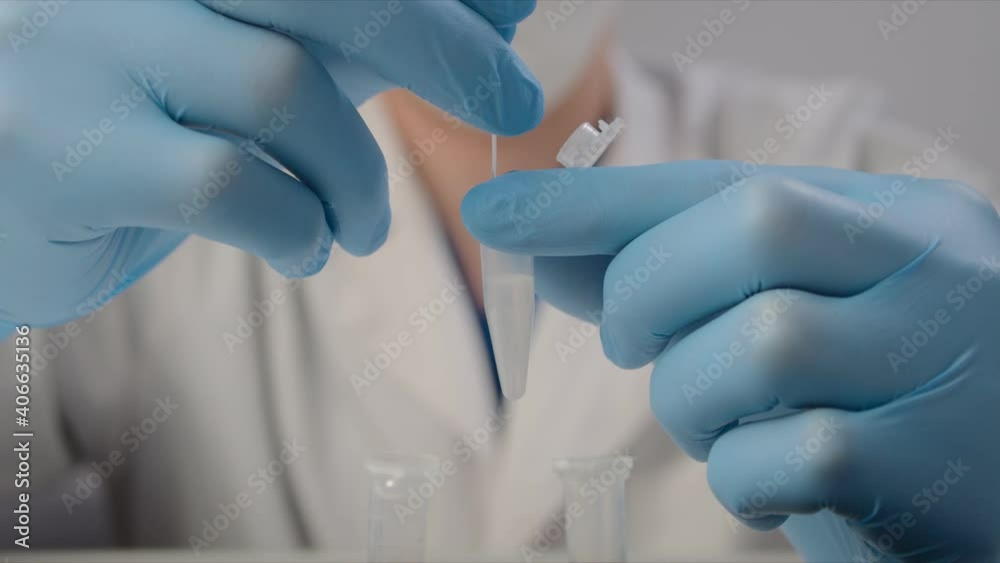 Nurse in latex gloves mixes materials for coronavirus test Nurse in latex gloves mixes materials for coronavirus test